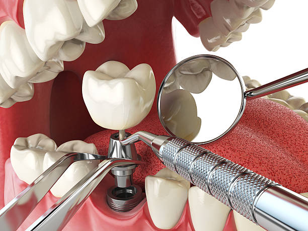 Best Emergency Treatment for Jaw Pain or Injury in Tunnel Hill, GA